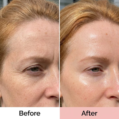 PDRN Collagen Glow Balm